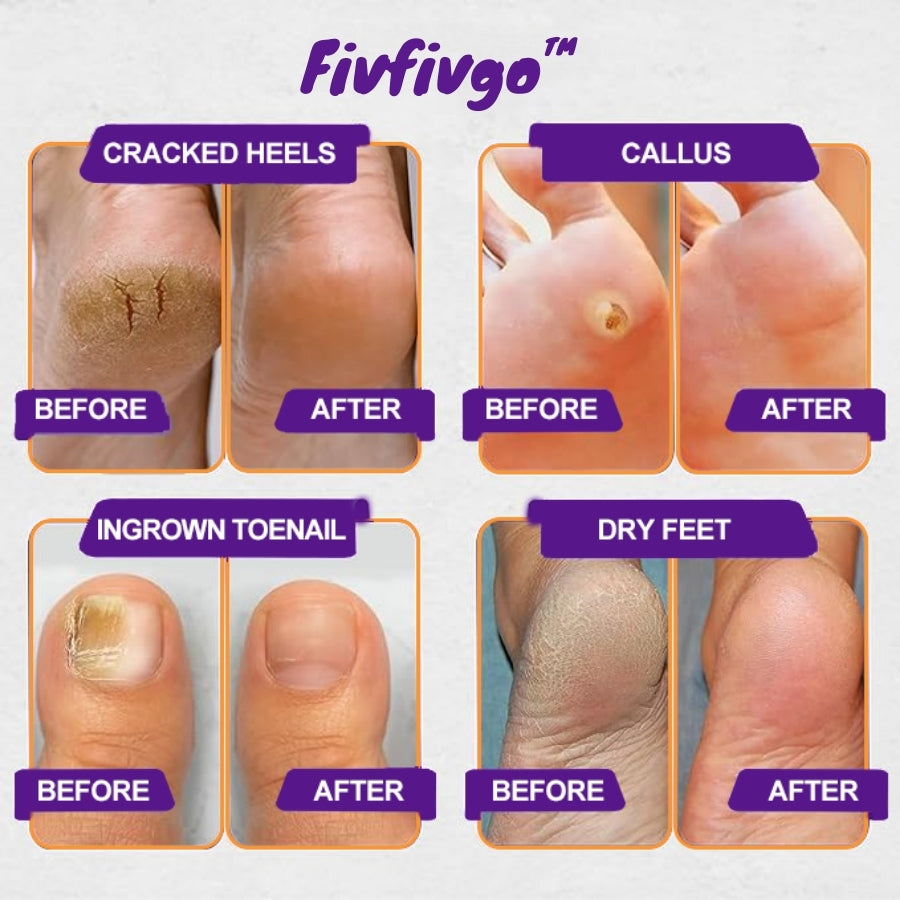 Fivfivgo™ Beinwell Bio Kräutersalbe