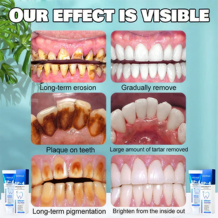 Fivfivgo™ SP-4 Probiotische Whitening-Zahnpasta