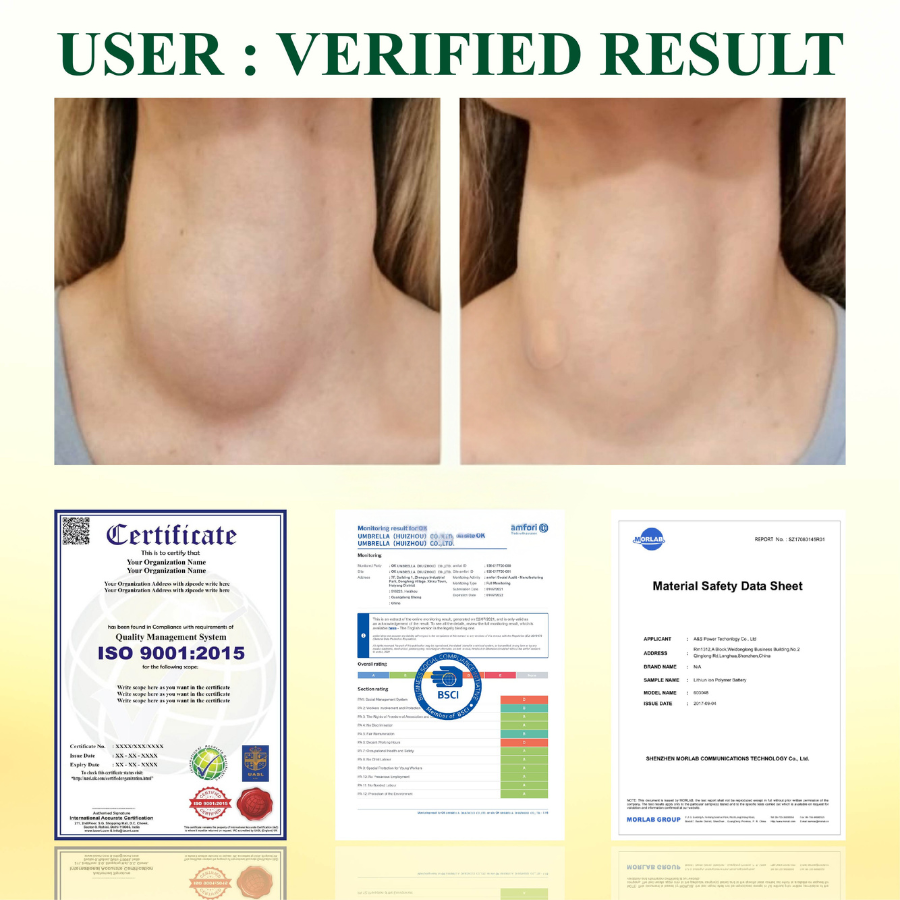 Fivfivgo™ Throat and CoughSoothing LymphOintment