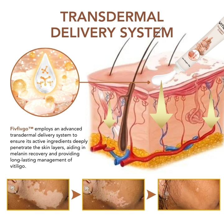 Fivfivgo™ Vitiligo Therapeutische Creme
