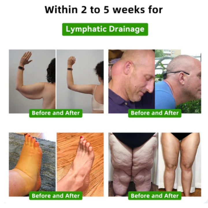 Fivfivgo™ Botanisches Lymphdrainage-Pflaster