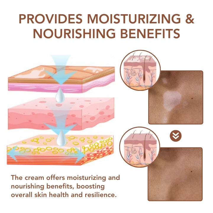 Fivfivgo™ Vitiligo Therapeutische Creme