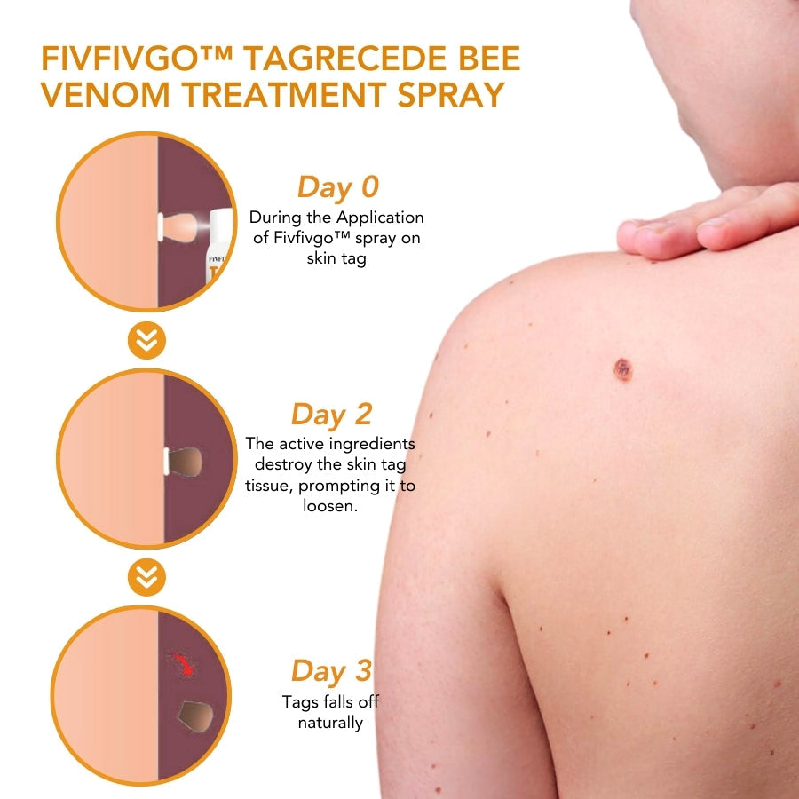 Fivfivgo™ TagRecede Spray de traitement au venin d'abeille