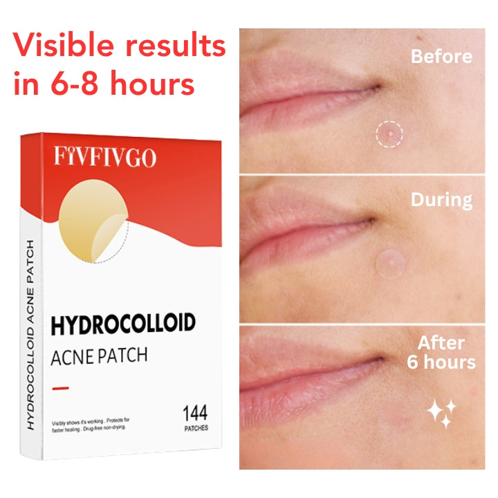 Fivfivgo™ Patch d'acné nocturne