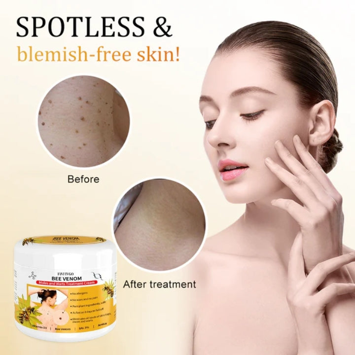 Fivfivgo™ Bee Venom Mole & Wart Treatment Cream