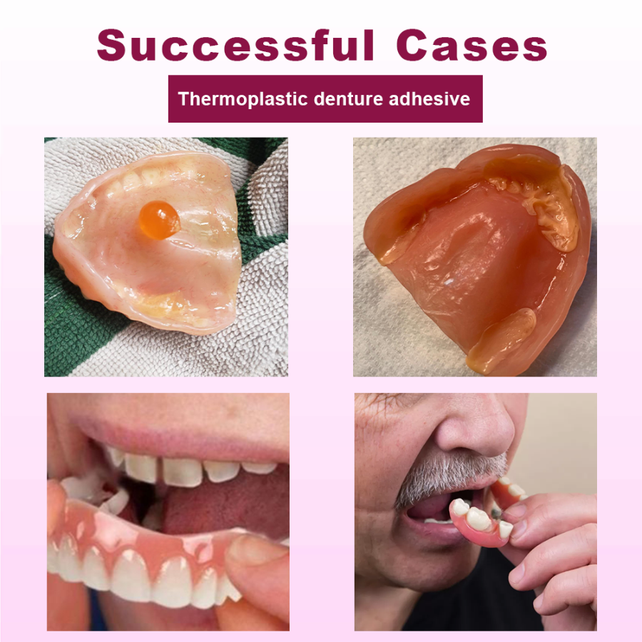 Fivfivgo™ SmileGrip Thermoplastic Denture Adhesive