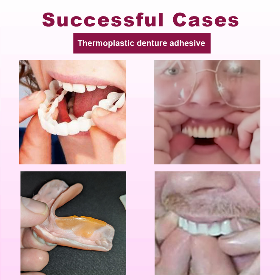 Fivfivgo™ SmileGrip Thermoplastic Denture Adhesive