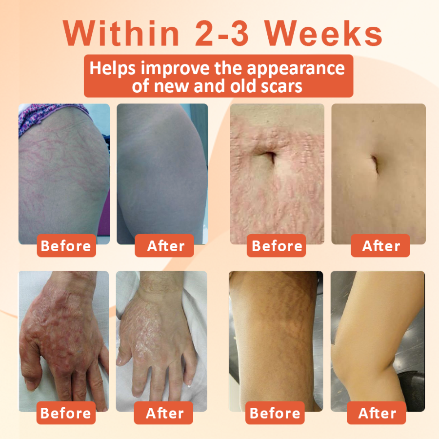 Fivfivgo™ Skin Firming and Scar Repair Oil