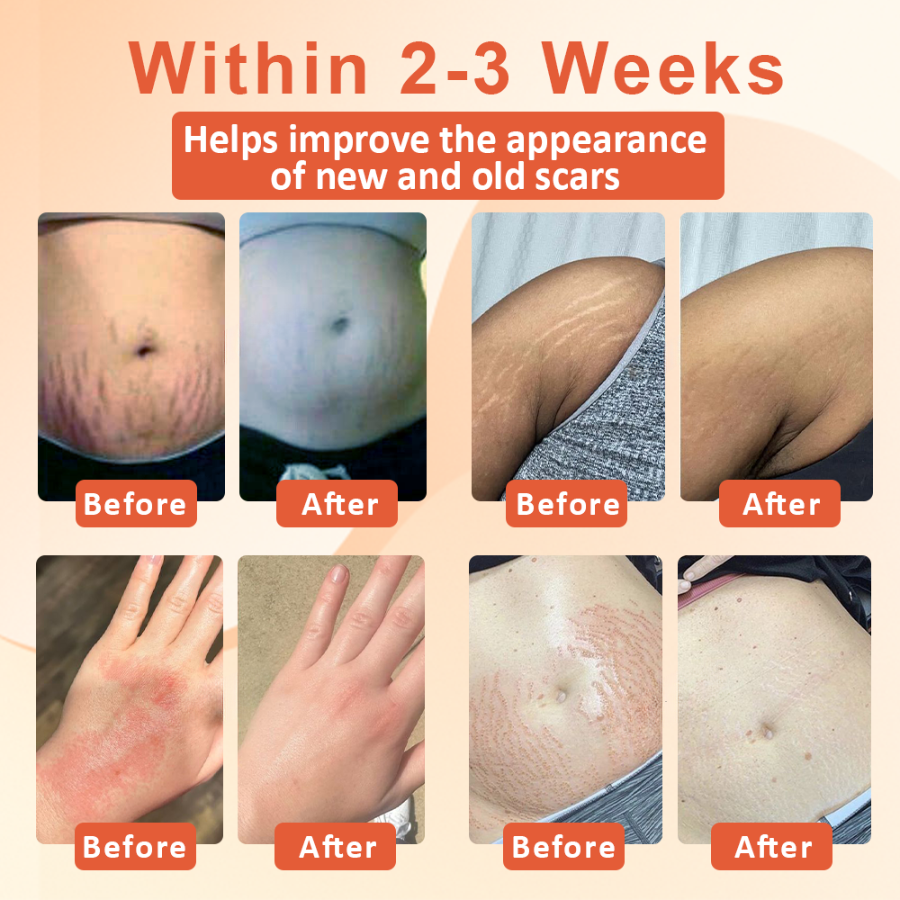 Fivfivgo™ Skin Firming and Scar Repair Oil