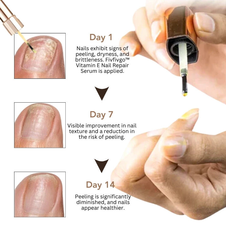 Fivfivgo™ Vitamin E Sérum réparateur pour les ongles