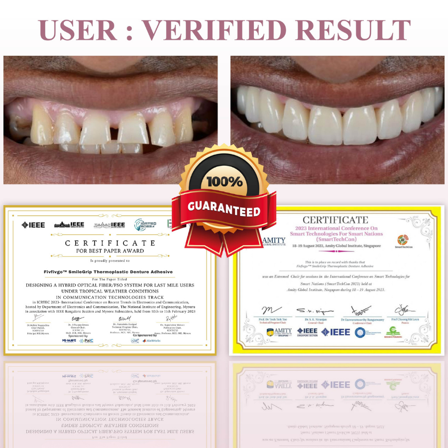 Fivfivgo™ SmileGrip Thermoplastic Denture Adhesive