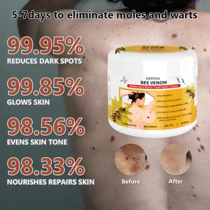 Fivfivgo™ Bee Venom Mole & Wart Treatment Cream