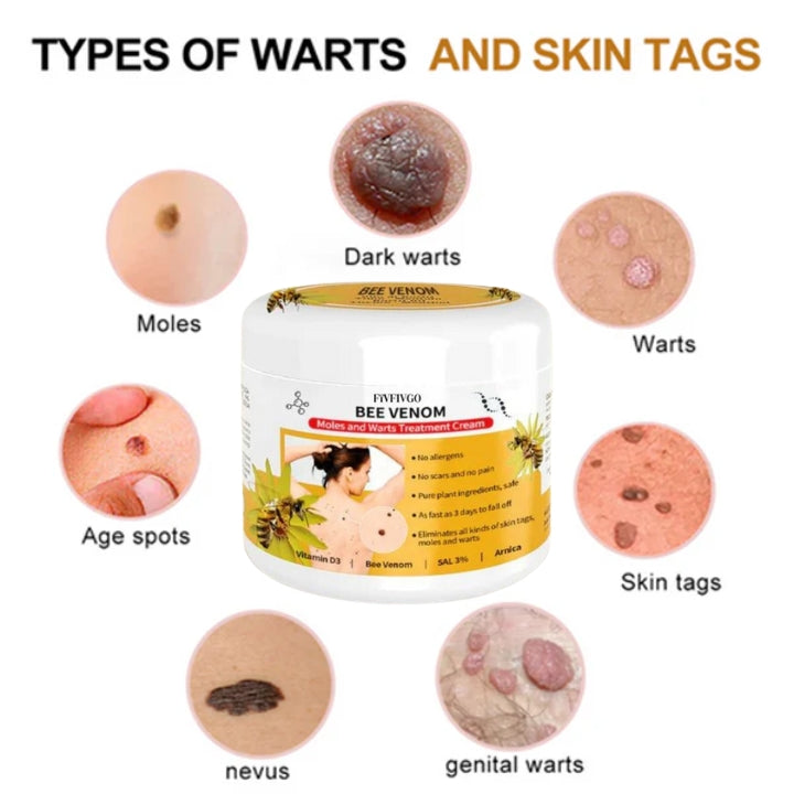 Fivfivgo™ Bee Venom Mole & Wart Treatment Cream