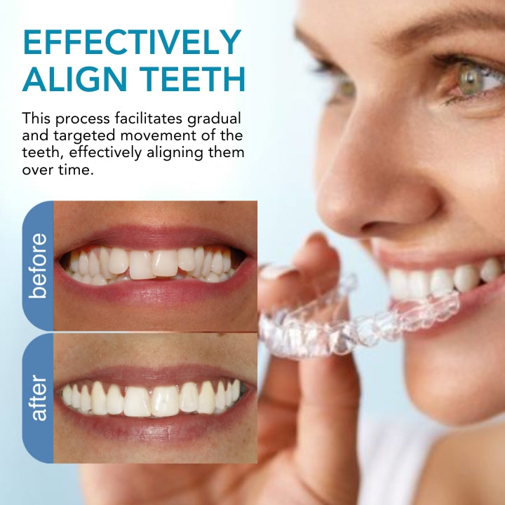 Fivfivgo™ Orthodontie Garde de redressement