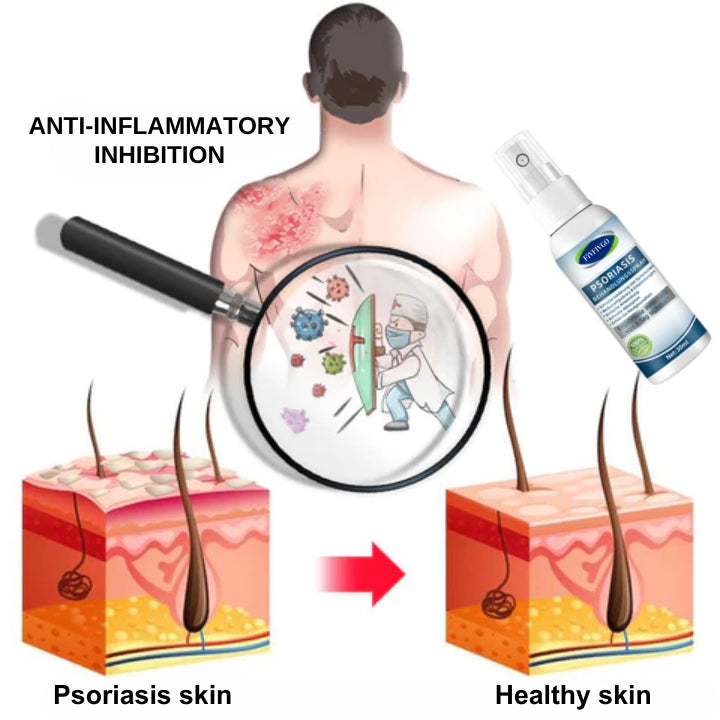 Fivfivgo™ Spray de Traitement du Psoriasis