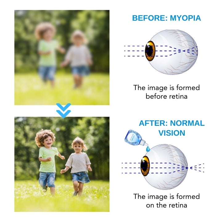 Fivfivgo™ VisioClear Tägliche Flüssiglinse