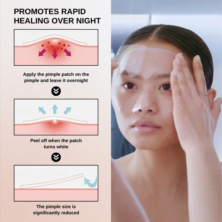 Fivfivgo™ Hydrogel Acne Patch