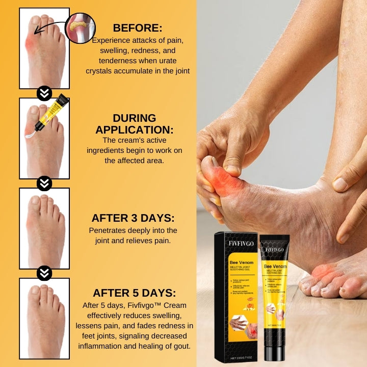 Fivfivgo™ GoutEase Bee Venom Cream