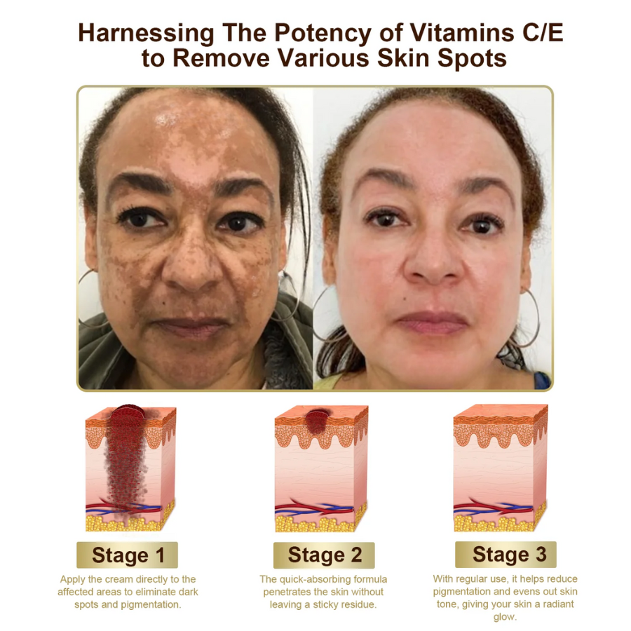 Fivfivgo™ Powerful All-Body Skin Treatment