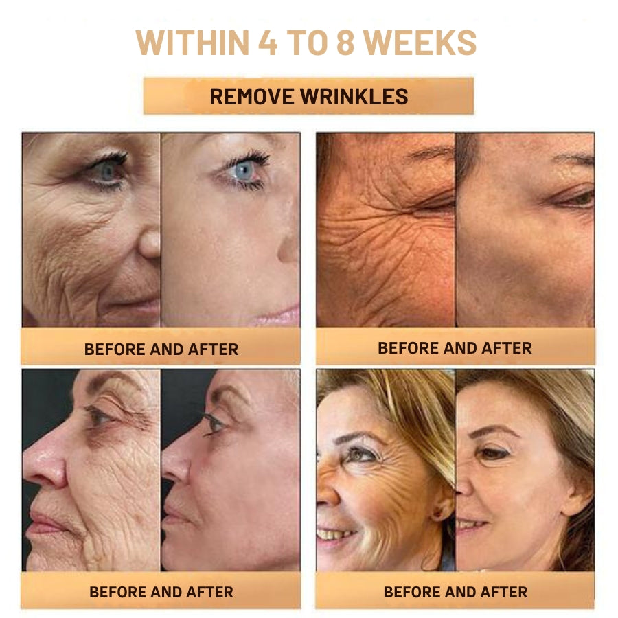 Fivfivgo™ Super Anti-Aging Cream