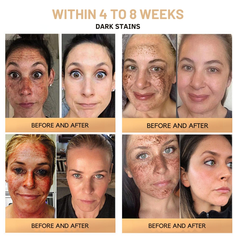 Fivfivgo™ Super Anti-Aging Cream