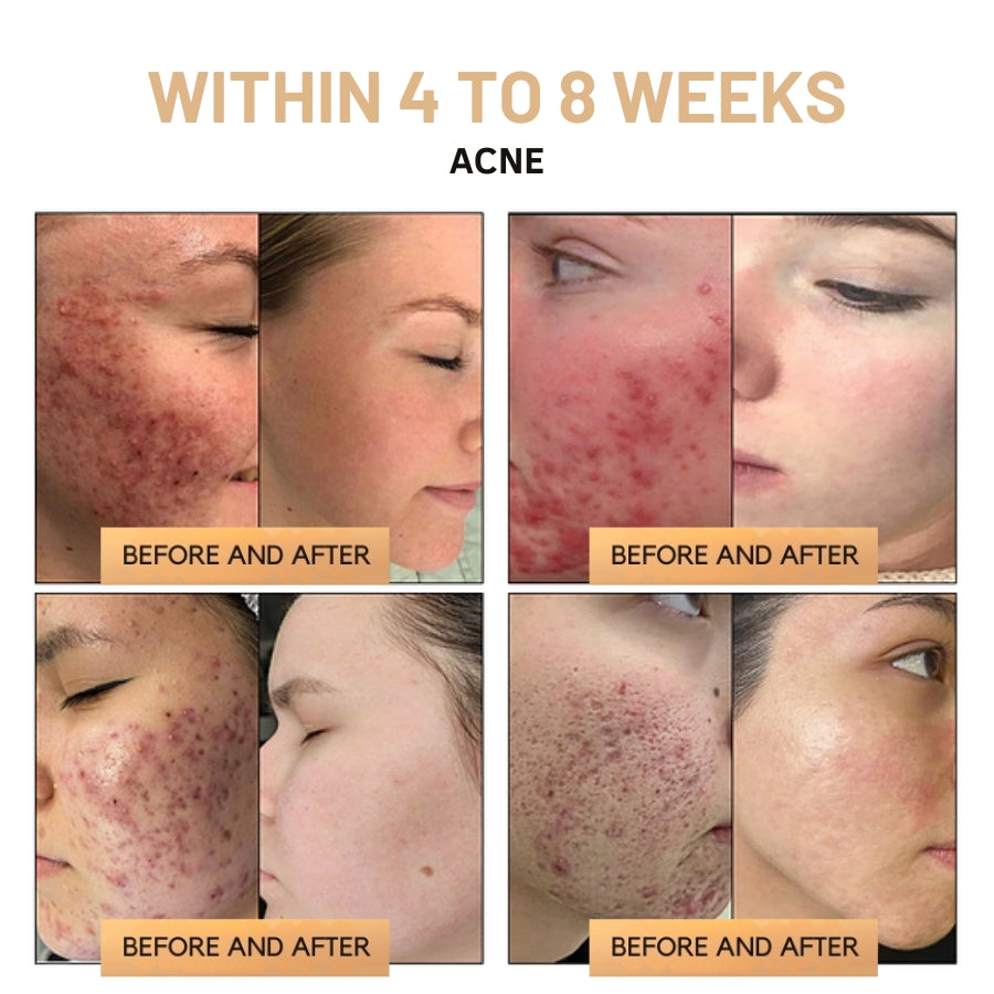 Fivfivgo™ Super Anti-Aging Cream