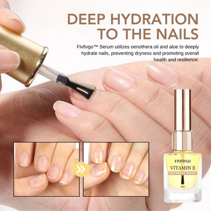 Fivfivgo™ Vitamin E Sérum réparateur pour les ongles