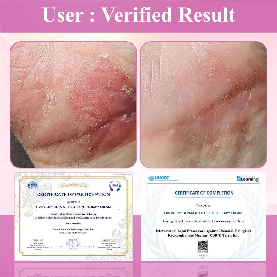 Fivfivgo™ Derma Relief Skin Therapy Cream