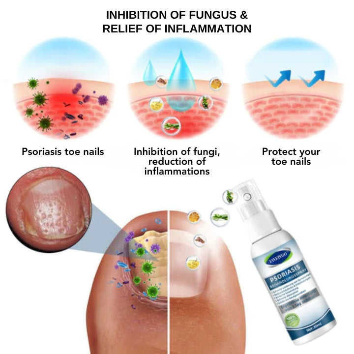 Fivfivgo™ Psoriasis-Behandlungsspray