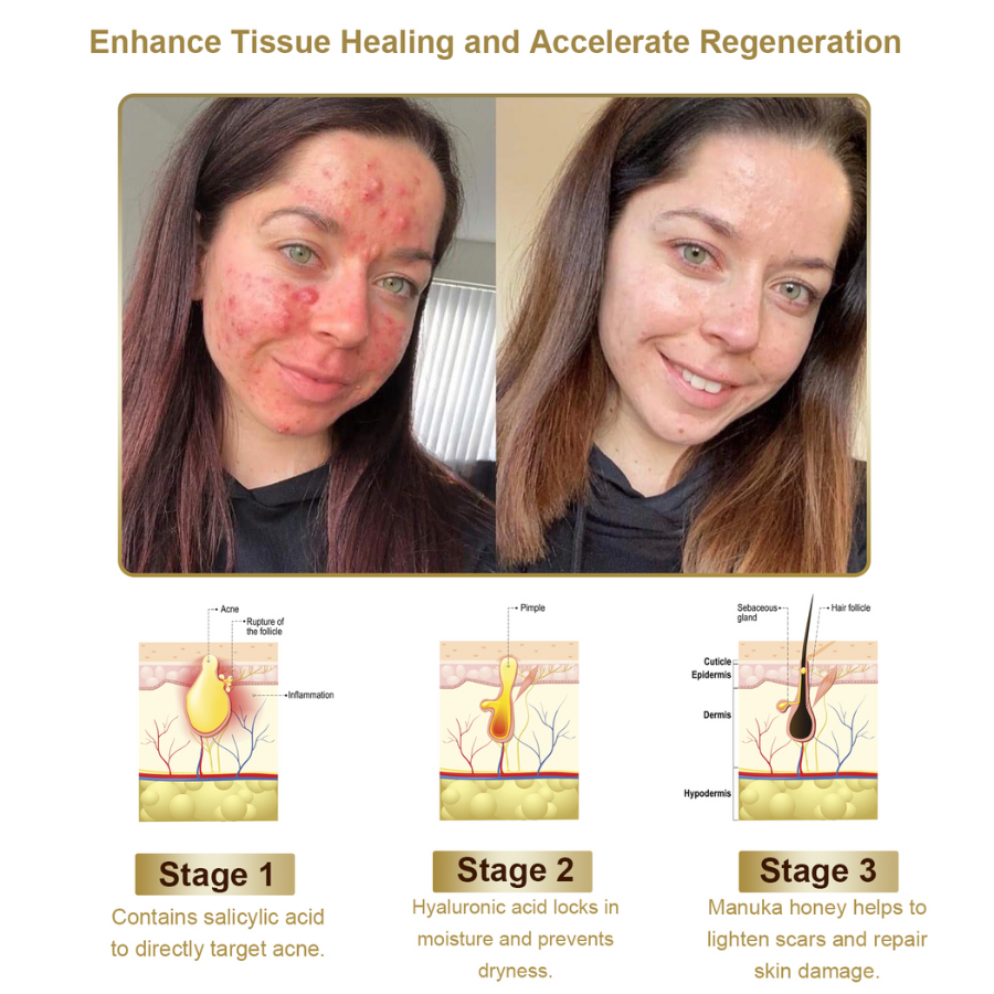 Fivfivgo™ Powerful All-Body Skin Treatment