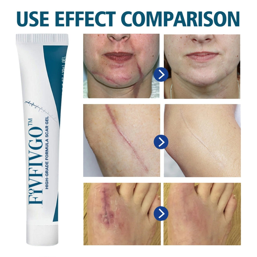 Fivfivgo™ PREMIUM FORMULA Scar Gel