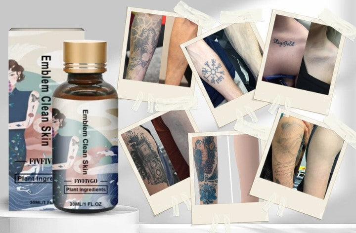 Fivfivgo™ Tattoo Removal Cream: Quick, Painless, and Scar-Free Tattoo Fading