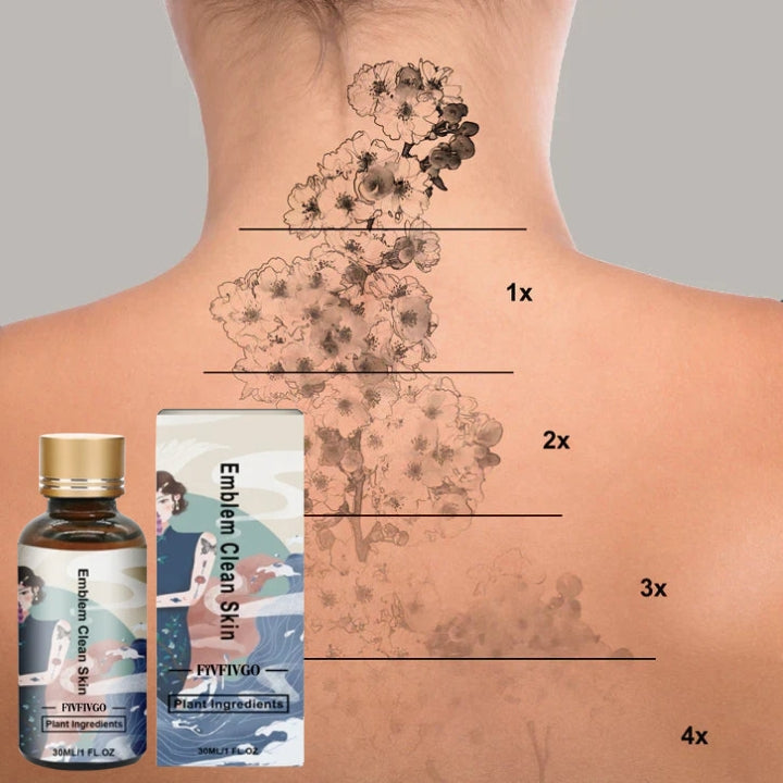 Fivfivgo™ Tattoo Removal Cream: Quick, Painless, and Scar-Free Tattoo Fading