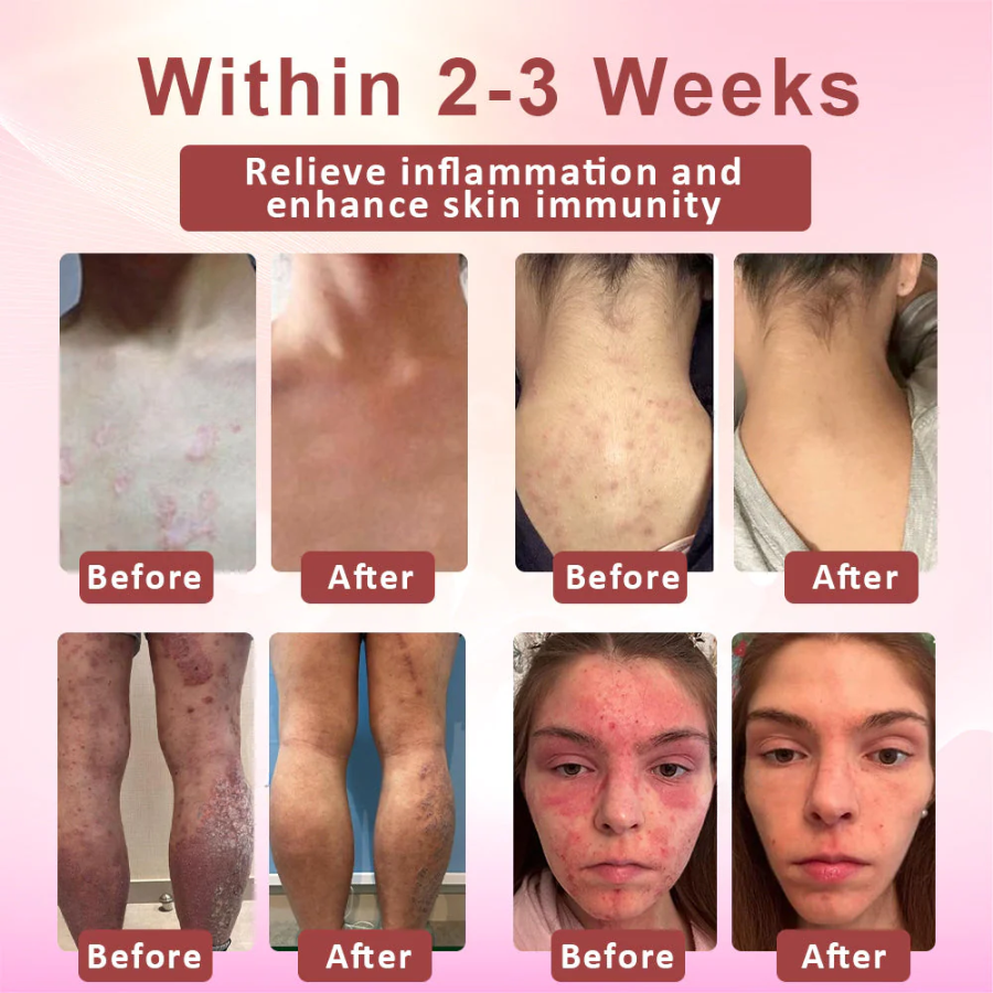 Fivfivgo™ Derma Relief Skin Therapy Cream