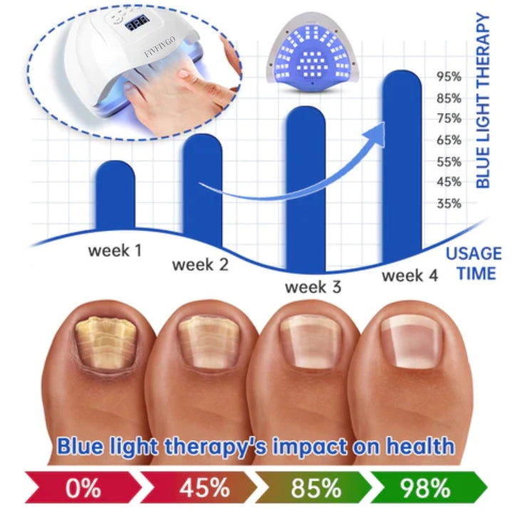 Fivfivgo™ PureNail Fungus Laser Therapy Device