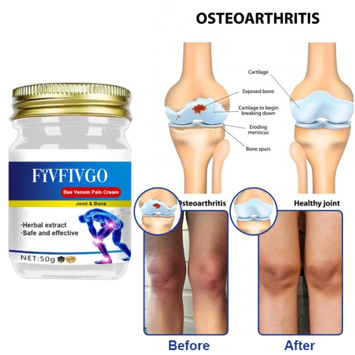 Fivfivgo™ Venin d'abeille Joint et Crème de guérison des douleurs osseuses
