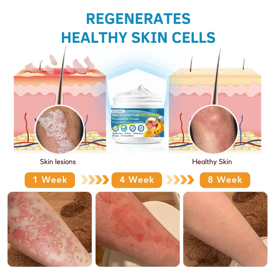 Fivfivgo™ Multi-Symptom Bee Venom Treatment Cream