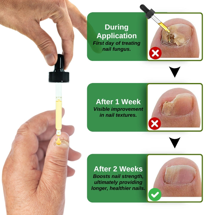 Fivfivgo™ FullNail Tea Tree Essential Oil