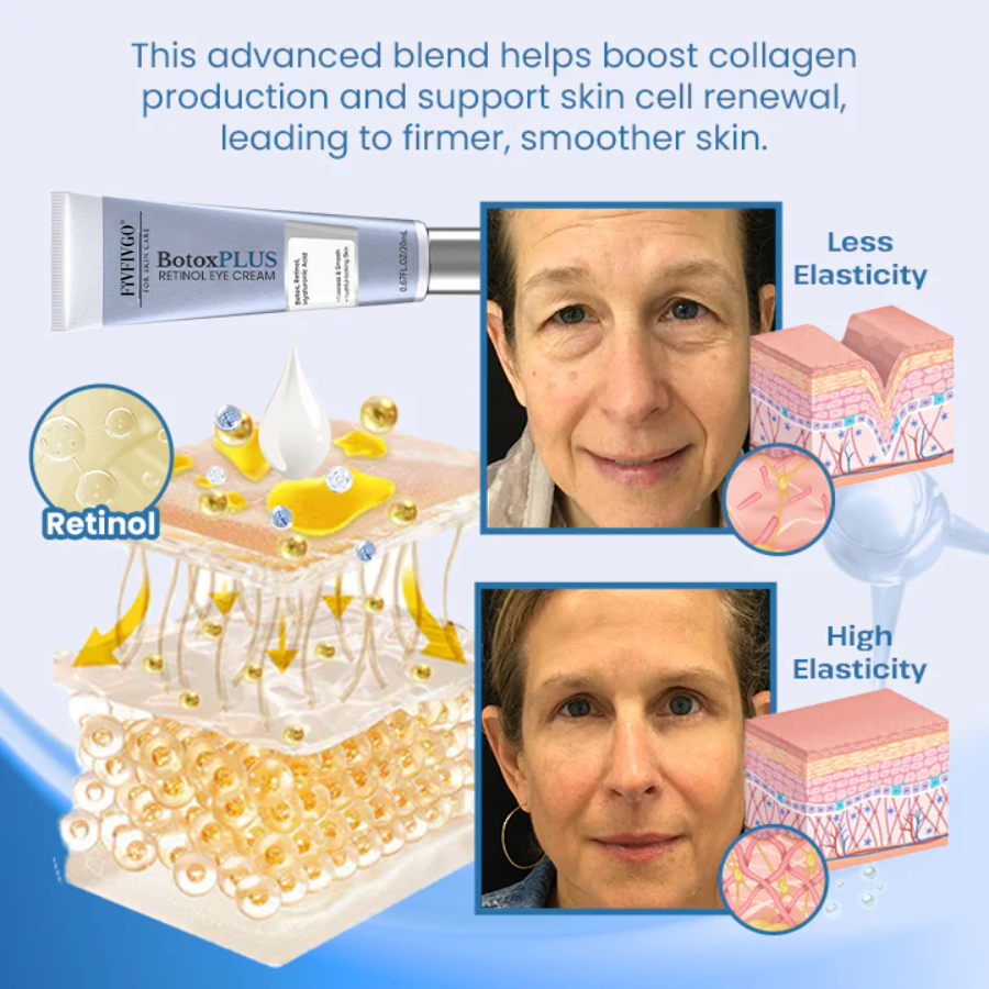 Fivfivgo® BotoxPLUS Retinol Eye Cream - Dermatologist Recommended (Eye Cream for Fine Lines, Wrinkles, Dark Circles, Dark Spots, and Daily Anti-Aging)