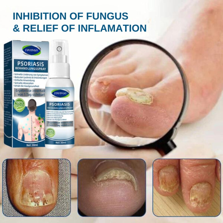 Fivfivgo™ Spray de Traitement du Psoriasis