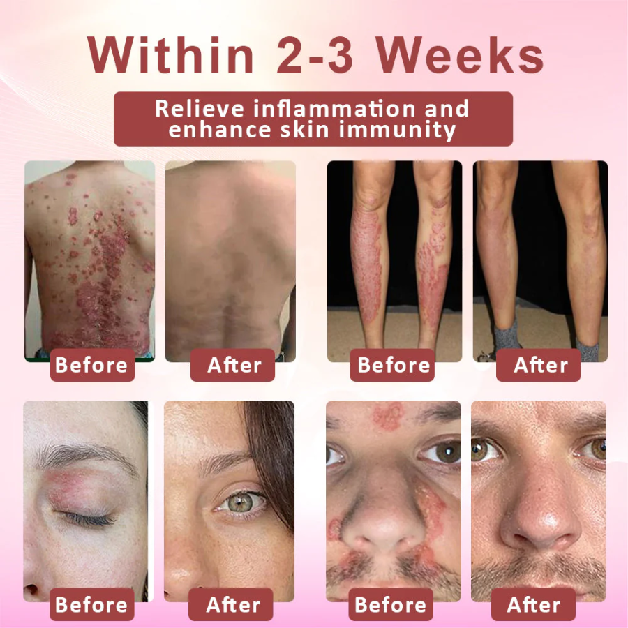 Fivfivgo™ Derma Relief Skin Therapy Cream