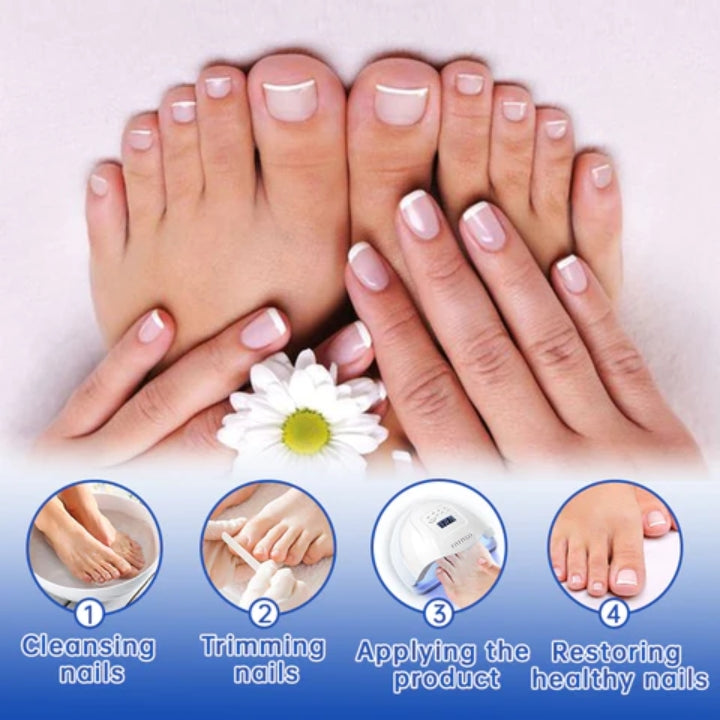 Fivfivgo™ PureNail Fungus Laser Therapy Device