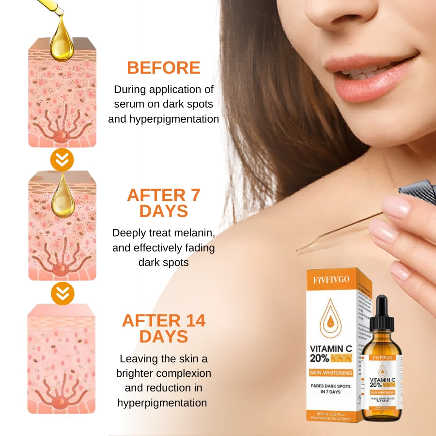 Fivfivgo™ Vitamin C Hautaufhellendes Serum