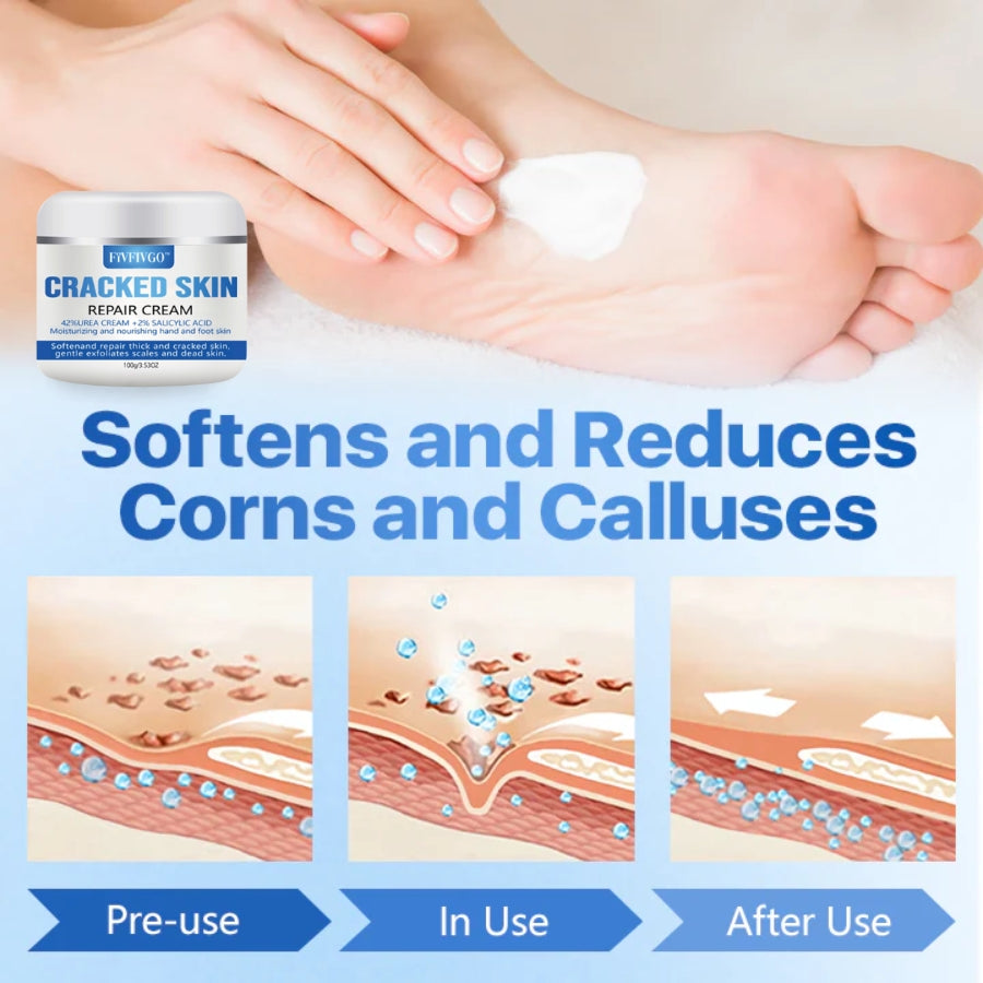 Fivfivgo™ Cracked Skin Repair Cream