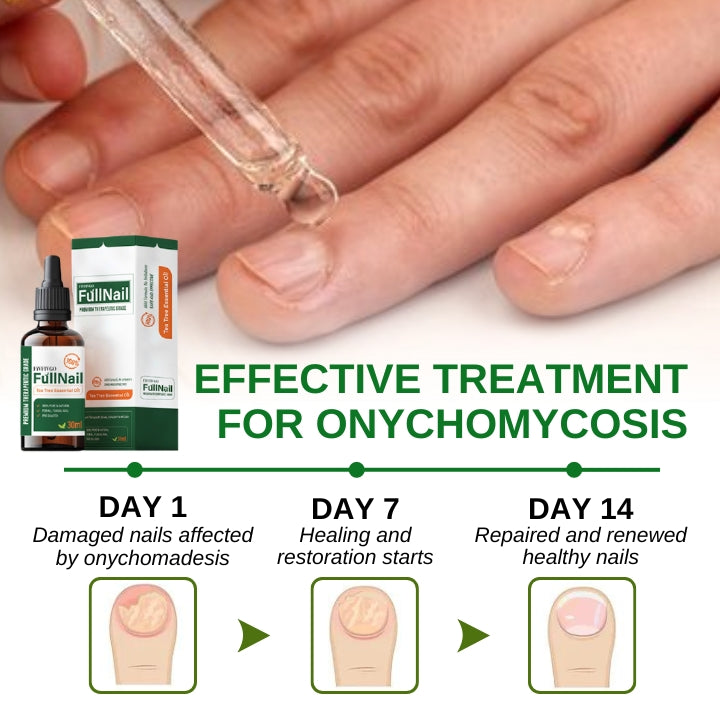 Fivfivgo™ FullNail Tea Tree Essential Oil