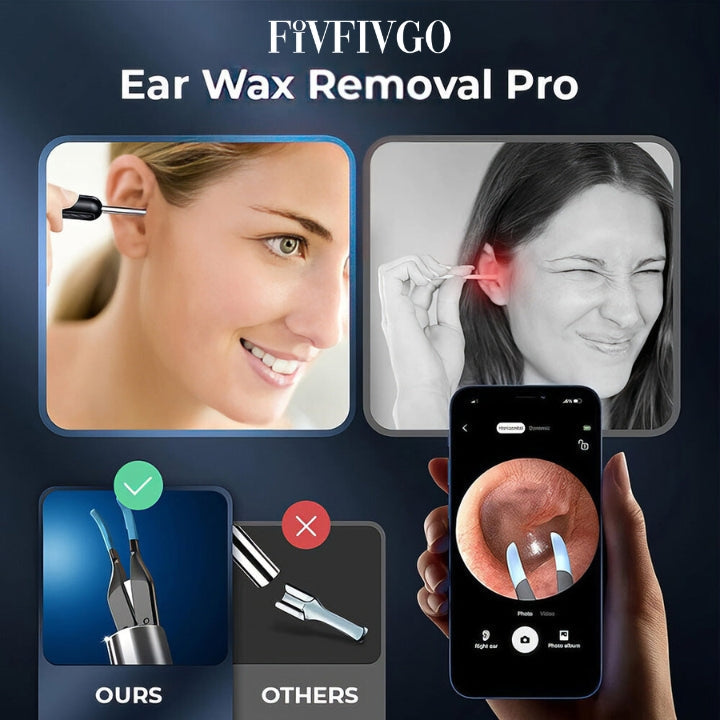 Fivfivgo™ Otoscope EarWax Clean Pro avec cuillère d'élimination du cérumen visible en Wi-Fi
