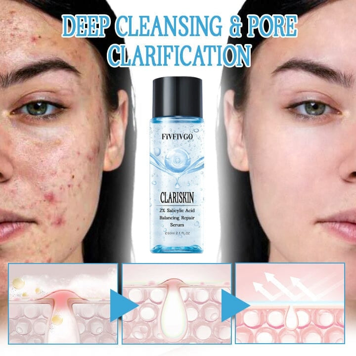 Fivfivgo™ ClariSkin 2% Salicylsäure Ausgleichendes Reparaturserum