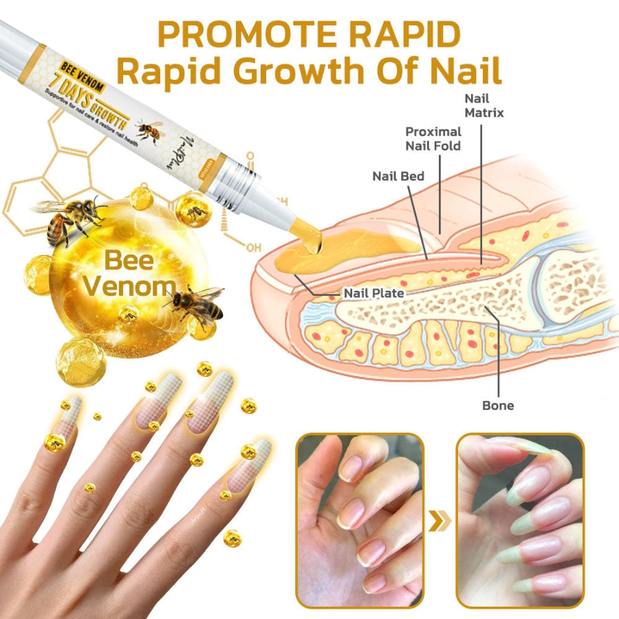 Fivfivgo™ NailPlus Starkes Bienengift 7 Tage Wachstum Nagelgel
