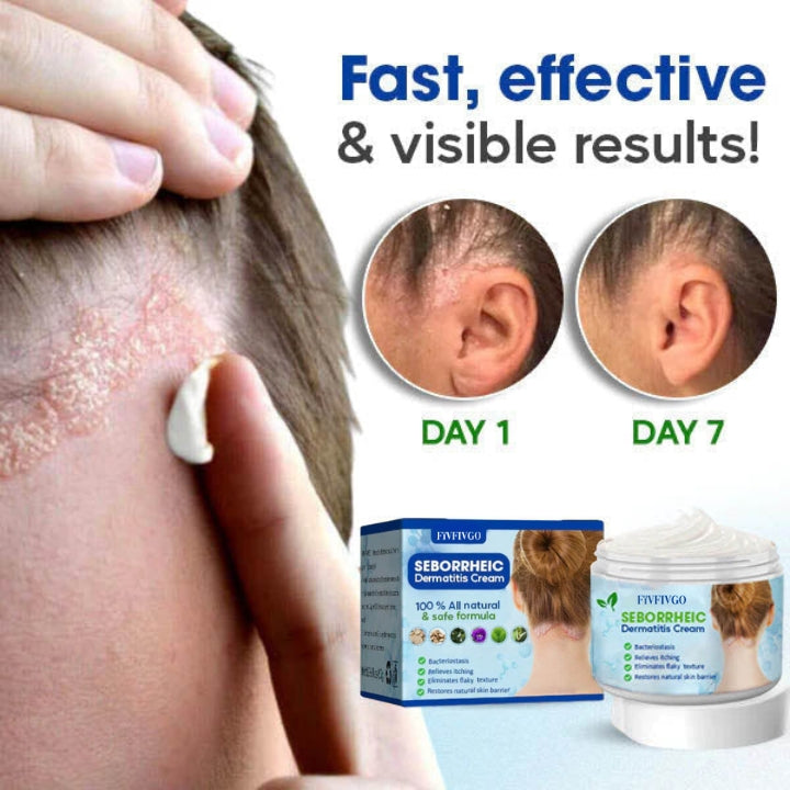 Fivfivgo™ Crème contre la dermatite séborrhéique