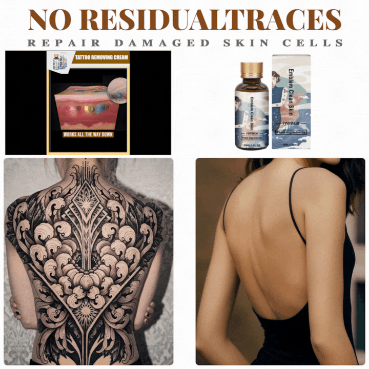 Fivfivgo™ Tattoo Removal Cream: Quick, Painless, and Scar-Free Tattoo Fading